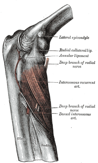 <span class="mw-page-title-main">Radial tunnel syndrome</span> Medical condition