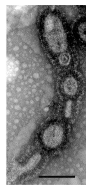 <span class="mw-page-title-main">Aciduliprofundum boonei</span> Species of archaeon