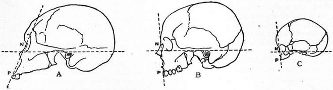 EB1911 Craniometry - Fig. 8.—Facial angles of the Frankfort Agreement.jpg