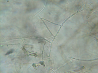 <i>Rhizoctonia solani</i> Species of fungus