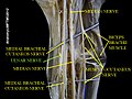 Thần kinh trụ (Ulnar nerve)