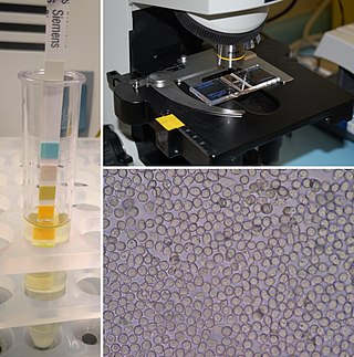 <span class="mw-page-title-main">Urinalysis</span> Array of tests performed on urine