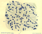 Sostanza nera (caso 4, Colorazione: blu di metilene, × 430).