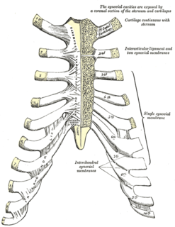 Tietze syndrome Inflammation, tenderness, and pain of the chest wall with swelling present