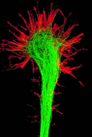 <span class="mw-page-title-main">Growth cone</span> Large actin extension of a developing neurite seeking its synaptic target