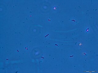 <i>Geobacter</i> Genus of anaerobic bacteria found in soil