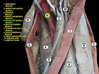 <span class="mw-page-title-main">Adductor minimus muscle</span> Small and flat skeletal muscle in the thigh