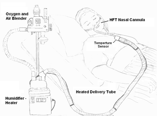 <span class="mw-page-title-main">Heated humidified high-flow therapy</span> Respiratory support method