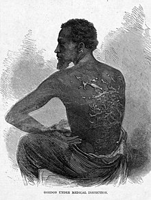 Illustration from Harper's Weekly, July 4, 1863, of Gordon, a slave who escaped to Union lines during the American Civil War, displaying scars from severe whippings WhippedGordonHarpers (cropped).JPG