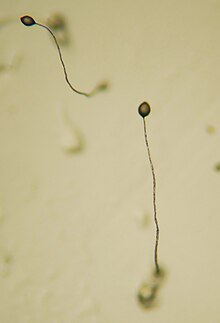 Dictyostelium Fruiting Bodies.JPG