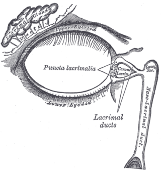 <span class="mw-page-title-main">Dacryocystocele</span> Medical condition