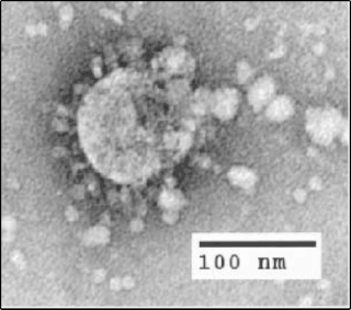 <span class="mw-page-title-main">SARS-CoV-1</span> Virus that causes SARS