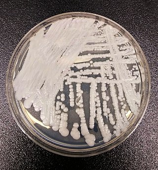 <i>Candida auris</i> Species of fungus