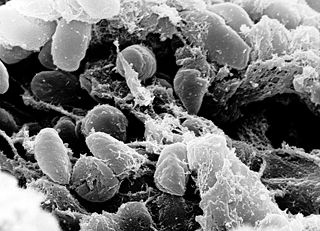 <i>Yersinia pestis</i> Species of bacteria, cause of plague