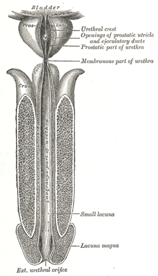 <span class="mw-page-title-main">Urethral stricture</span> Medical condition