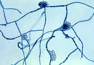 <span class="mw-page-title-main">Tinea nigra</span> Medical condition