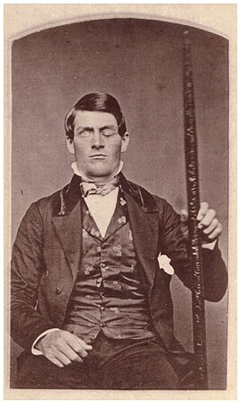 Phineas Gage