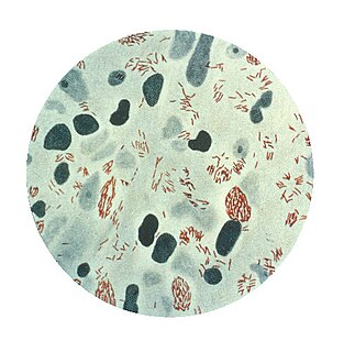 <i>Mycobacterium leprae</i> Bacterium that causes leprosy