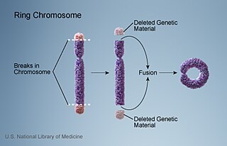 <span class="mw-page-title-main">Ring chromosome 15</span> Medical condition