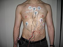 Holter monitor.JPG