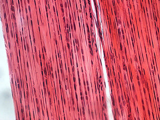 <span class="mw-page-title-main">Dense connective tissue</span> Type of connective tissue in animals