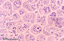 Meiosis in Grasshopper testes (primary spermatocytes in zygotene, pachytene, prophase I). Meiosis (248 23).jpg