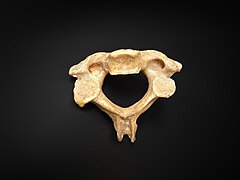 Vertebra - axis.jpg