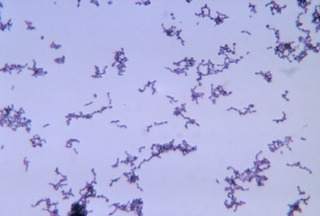 <i>Propionibacterium</i> genus of bacteria