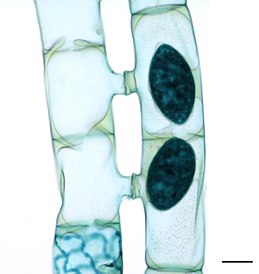 Konjugáció a Spirogyra nemzetségben.