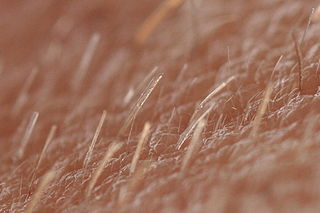 <span class="mw-page-title-main">Vellus hair</span> Type of hair that is short, thin, slight-colored, and barely noticeable