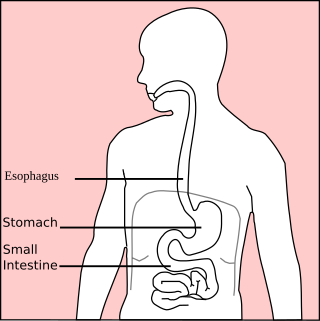 Stomach disease Medical condition