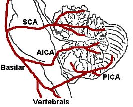 {De grote slagaders van het cerebellum, de SCA, AICA, en PICA.