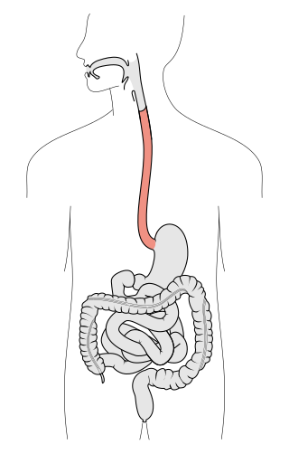 <span class="mw-page-title-main">Esophagus</span> Vertebrate organ through which food passes to the stomach