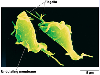 <span class="mw-page-title-main">Trichomonadida</span> Order of flagellated protists