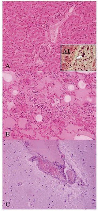 <span class="mw-page-title-main">Lactic acid bacteria</span> Order of bacteria