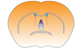 <span class="mw-page-title-main">Medial septal nucleus</span>