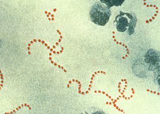 <span class="mw-page-title-main">Group A streptococcal infection</span> Medical condition