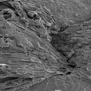 <span class="mw-page-title-main">Conceptacle</span> Specialized cavities in algae