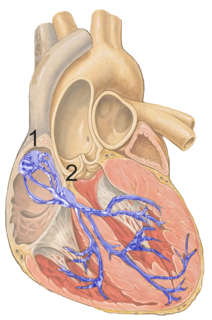 Sinoatrial node Group of cells located in the wall of the right atrium of the heart