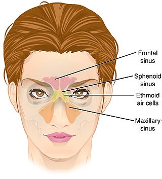 <span class="mw-page-title-main">Paranasal sinuses</span> Air-filled spaces surrounding the nasal cavity