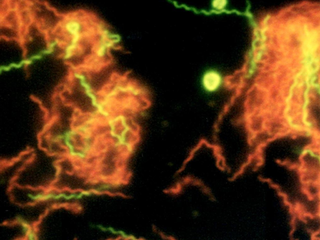 <span class="mw-page-title-main">Spirochaetaceae</span> Family of bacteria