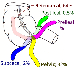 <span class="mw-page-title-main">Appendix (anatomy)</span> Tube attached to the intestine