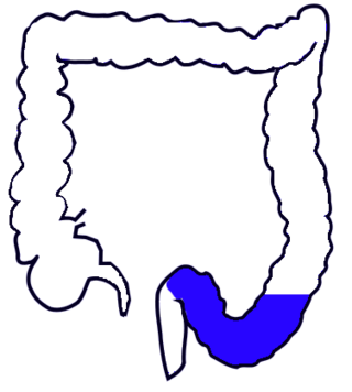 <span class="mw-page-title-main">Sigmoid colon</span> Section of the large intestine closest to the rectum and anus