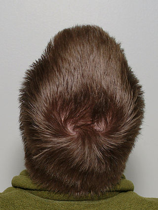 <span class="mw-page-title-main">Scalp</span> Anatomical area bordered by the face at the front, and by the neck at the sides and back