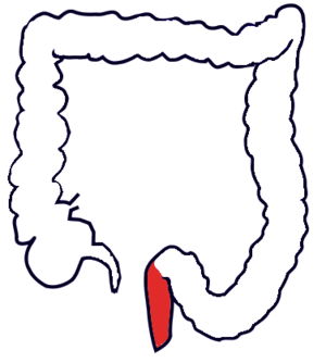 Intestinum crassum cum recto