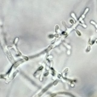 <i>Trichophyton rubrum</i> Species of fungus