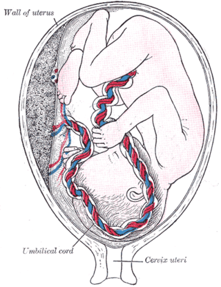 <span class="mw-page-title-main">Percutaneous umbilical cord blood sampling</span>