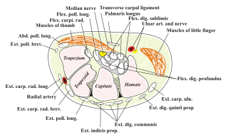 <span class="mw-page-title-main">Ulnar canal</span> Passageway through the wrist for the ulnar nerve and artery