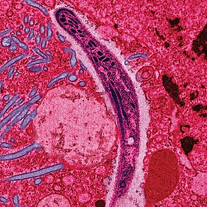 Infection Invasion of an organisms body tissues by disease-causing agents