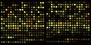 Complementary DNA Single-stranded DNA synthesized from an RNA template by the action of an RNA-dependent DNA polymerase